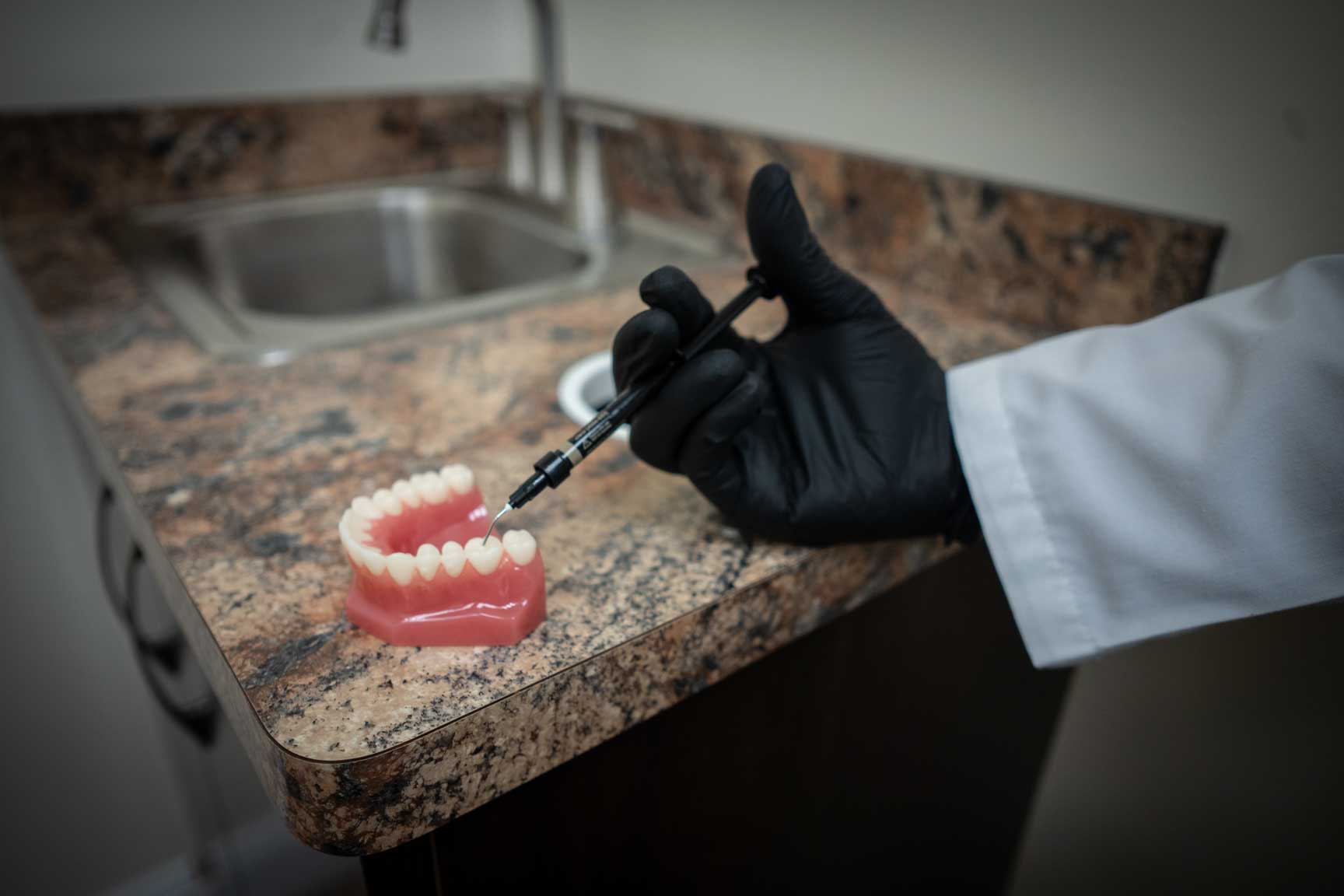 A photo of a dental sealant on a dental tooth model