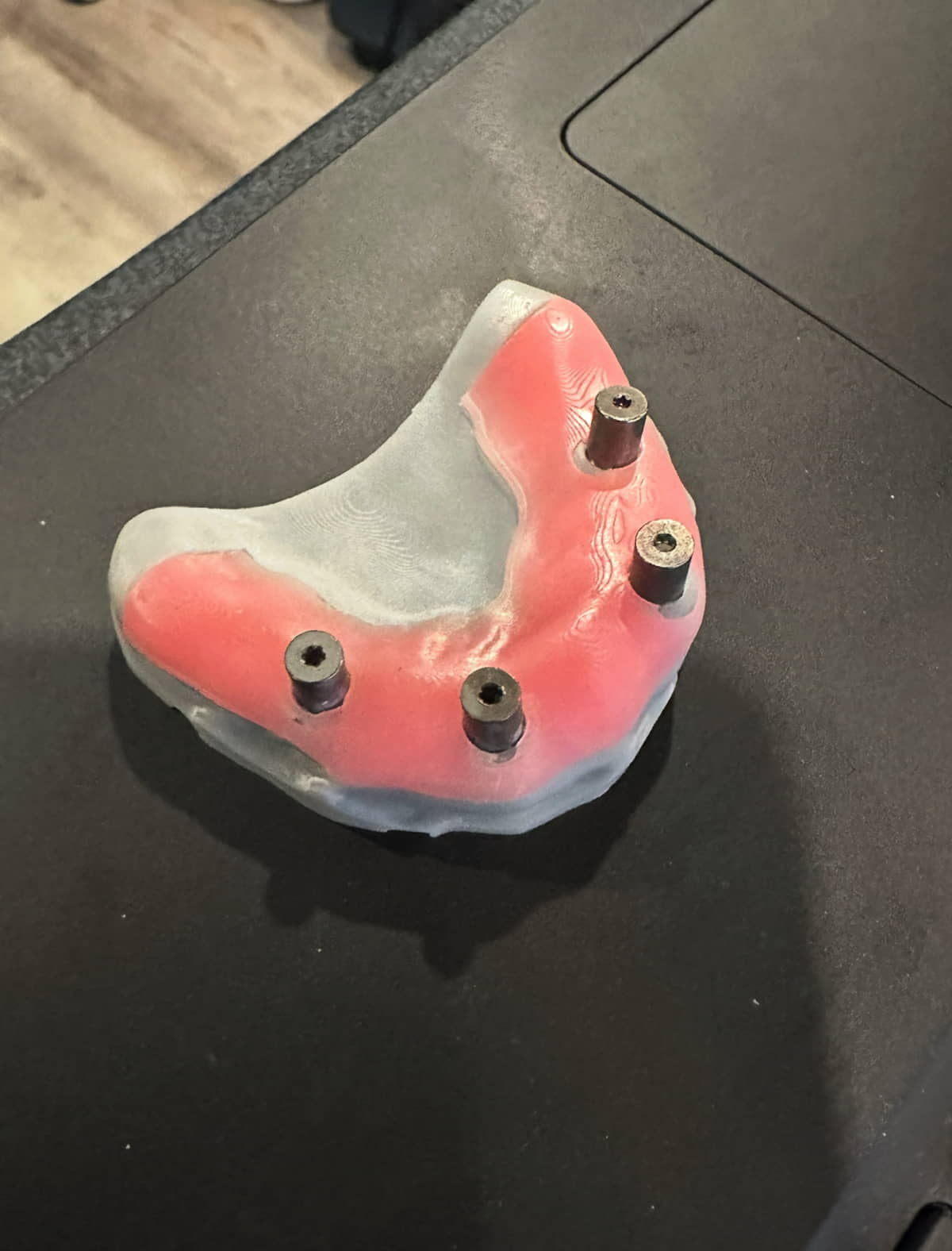 Dentist Offers All-on-X in New Jersey-resized