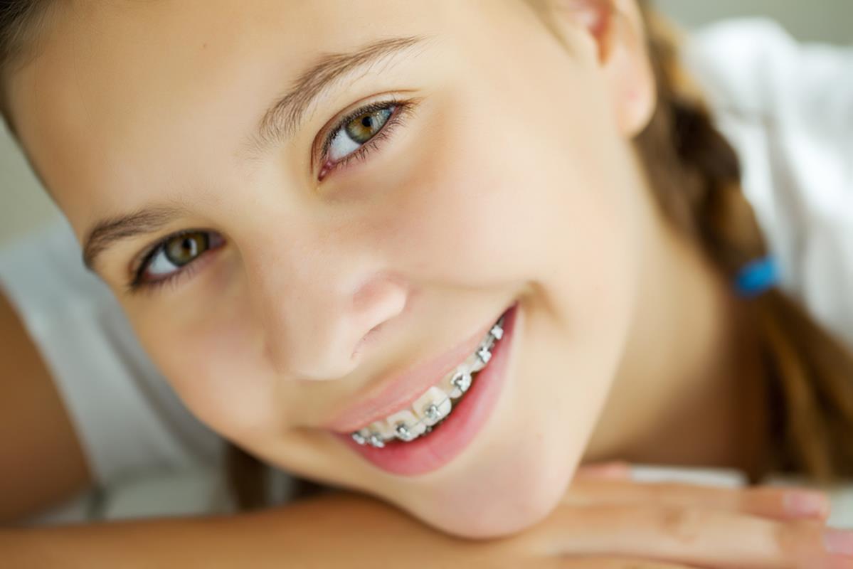 orthodontics - traditional braces
